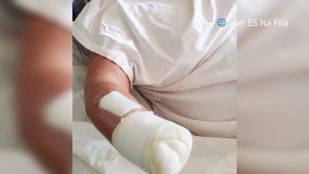 Mulher agredida com foice e facão tem a mão amputada no ES